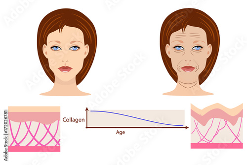 Vector faces and two types of skin - aged and young for medical and cosmetological illustrations
