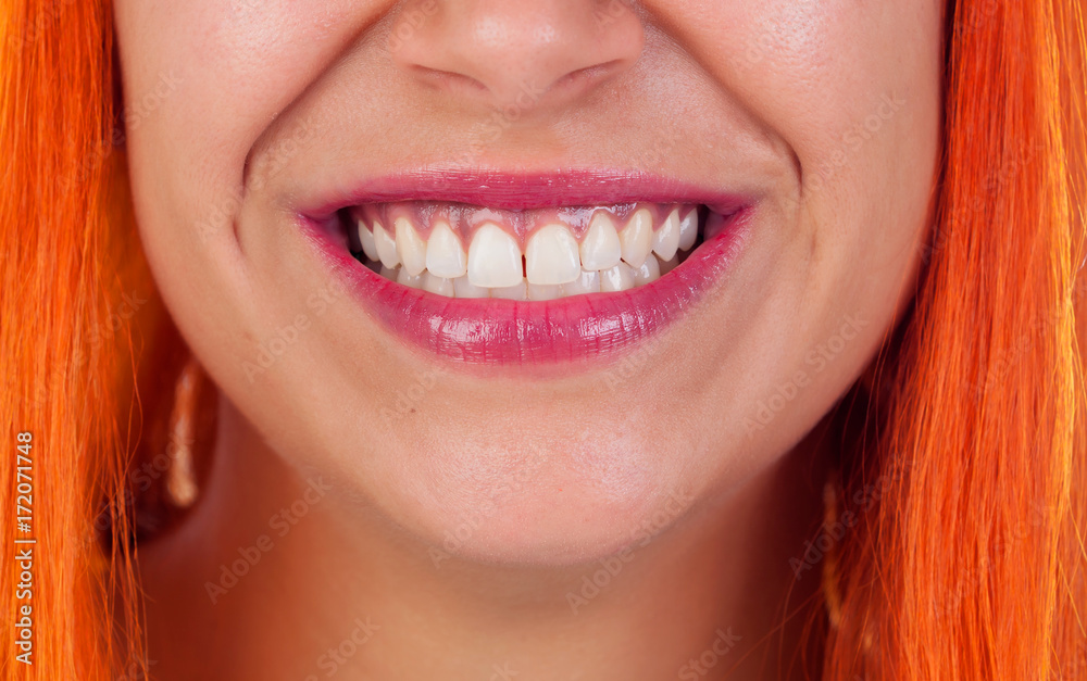Beautiful smile of a redhead woman Beautiful smile of a redhead woman