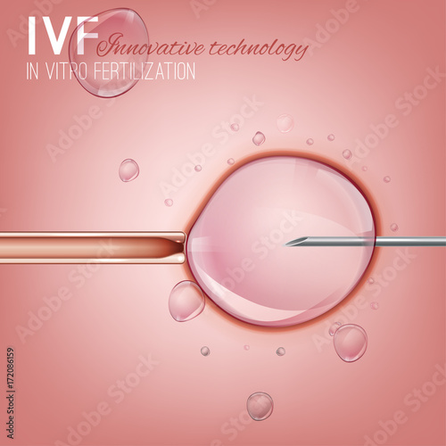 In Vitro Fertilization