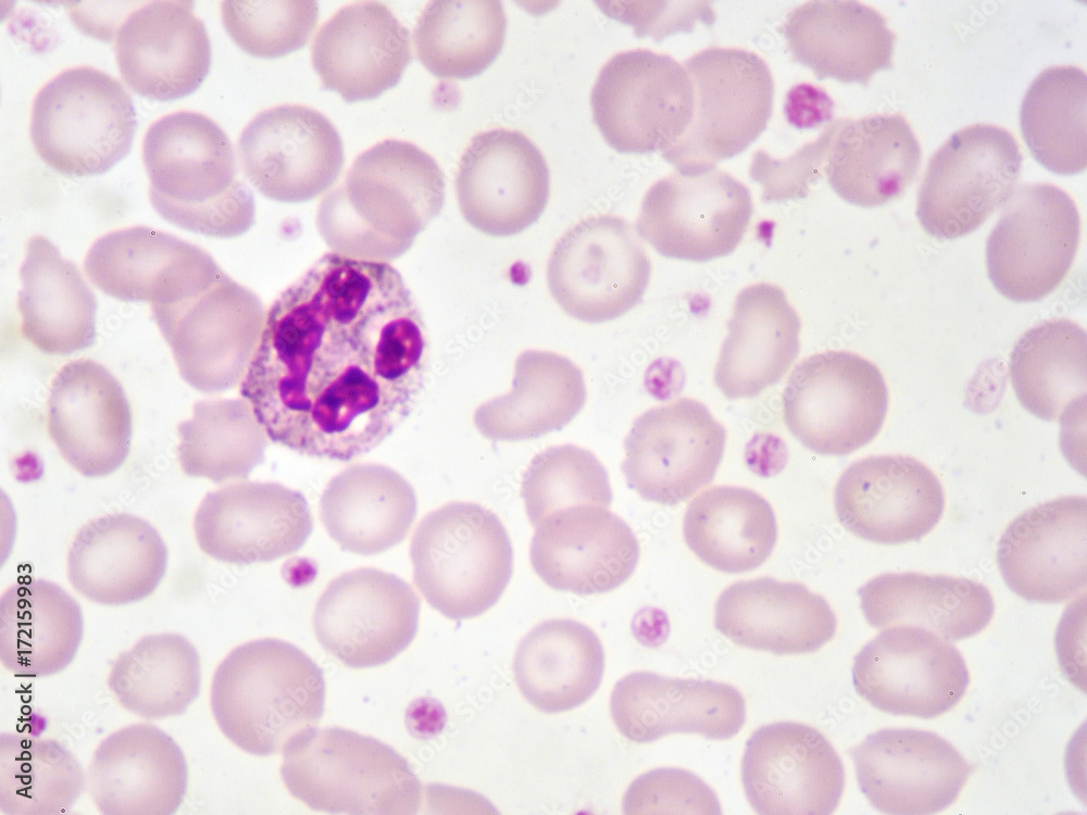 Neutrophil cell (white blood cell) in blood smear, analyze by microscope  Stock Photo | Adobe Stock