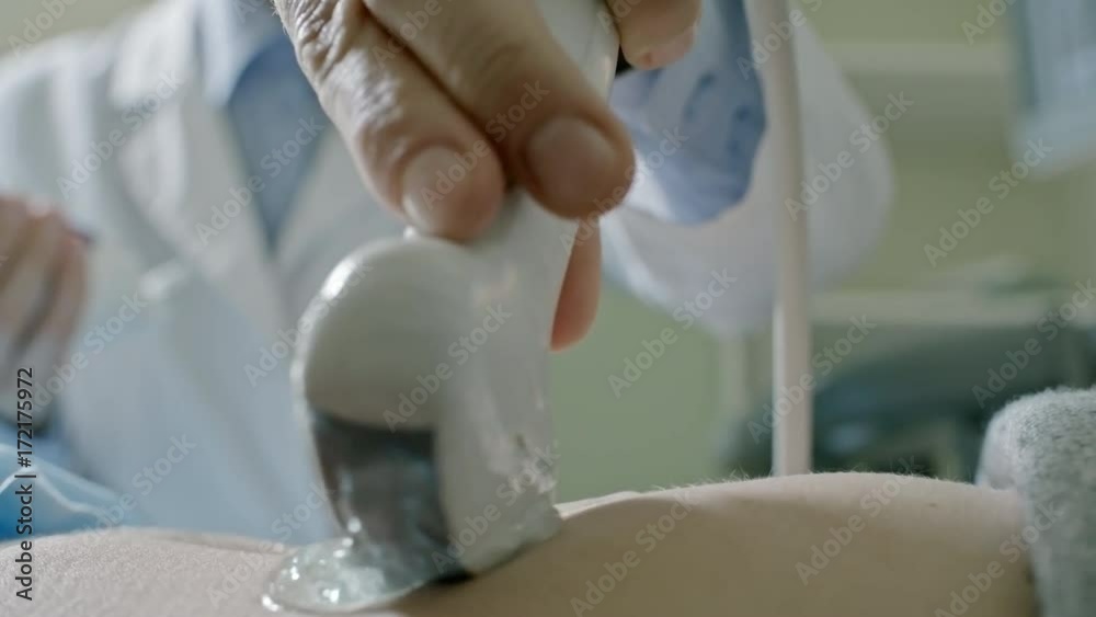 Close up of hand of unrecognizable female doctor holding transducer probe and performing abdominal ultrasound on patient Close up of hand of unrecognizable female doctor holding transducer probe and performing abdominal ultrasound on patient