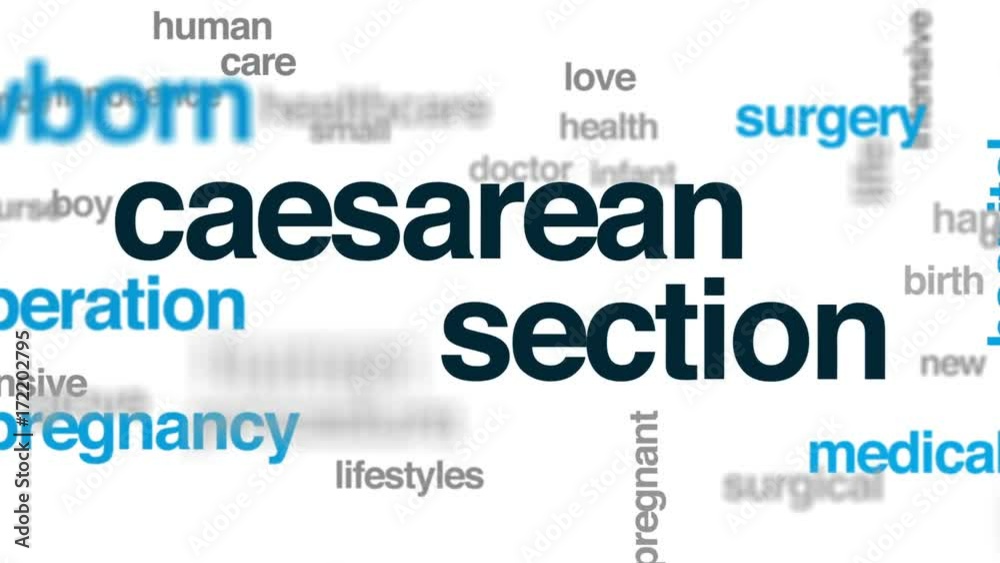 Caesarean section animated word cloud, text design animation. Caesarean section animated word cloud, text design animation.