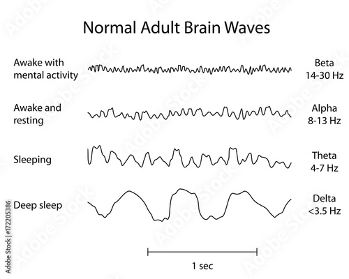 Normal Brain Waves EEG photo