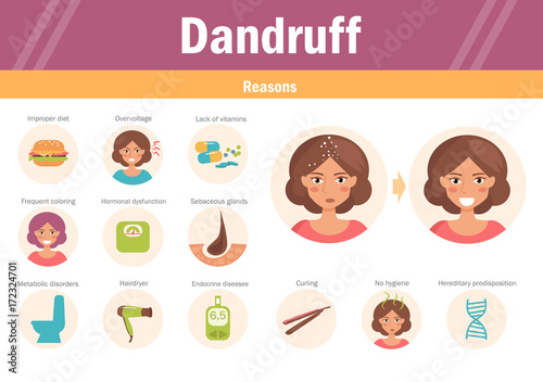 Reasons of dandruff. Vector.