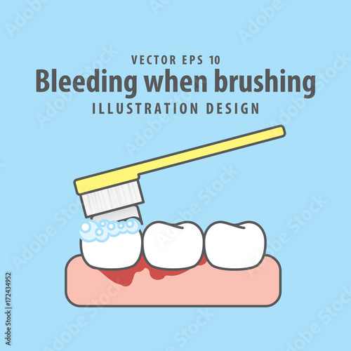 Bleeding when brushing illustration vector on blue background. Dental concept.
