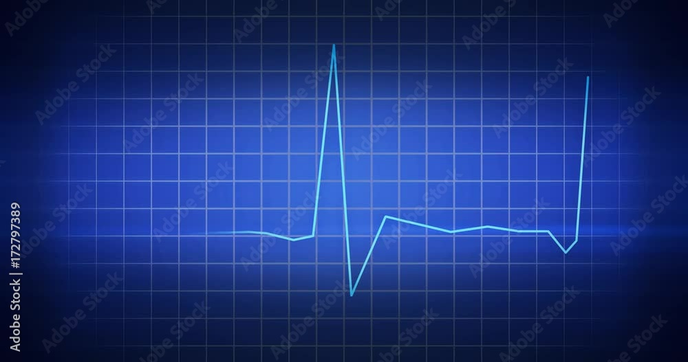 EKG Heartbeat Monitor EKG Heartbeat Monitor