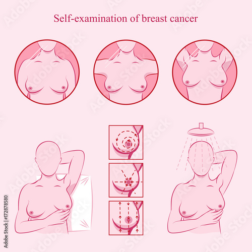 Self examination of breast cancer. Medicine, pathology, anatomy, physiology, health. Info-graphic. Vector illustration. Healthcare poster or banner template.
