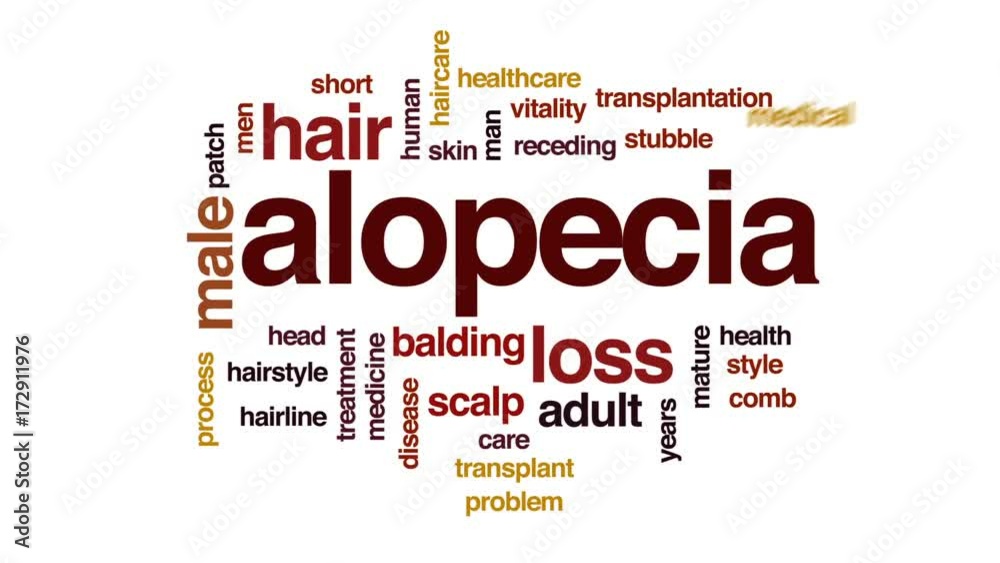 Alopecia animated word cloud, text design animation. Alopecia animated word cloud, text design animation.