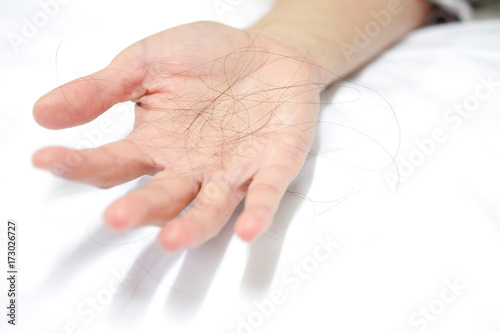 Many hair loss in the hands of women on white background