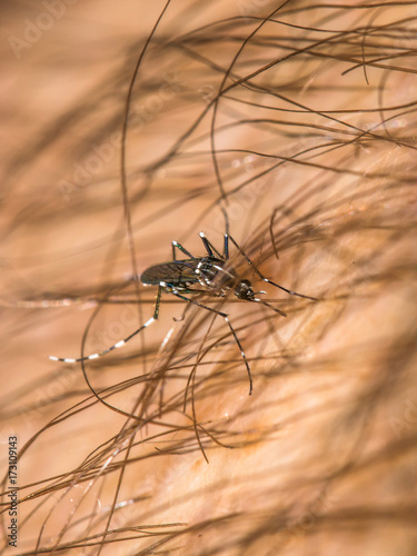 Vertical photo of a mosquito feeding on a caucasian male through thick body hair