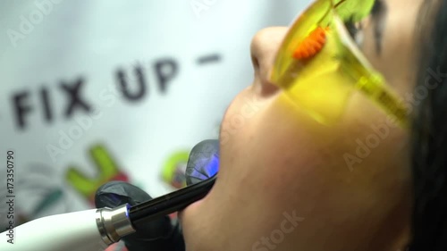 Dentist using ultraviolet lamp on patients teeth. Dental procedure scene. Close up portrait of a patient in yellow glasses getting UV whitening at the dentist in black gloves. Close up. Professional photo