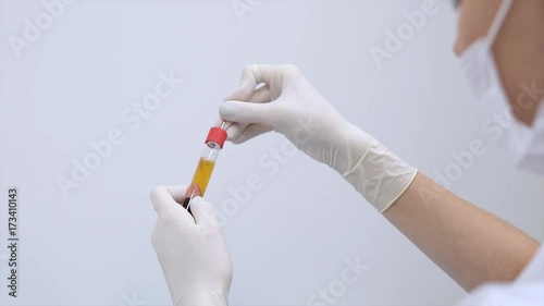 Doctor holding a beautician shows blood plasma photo