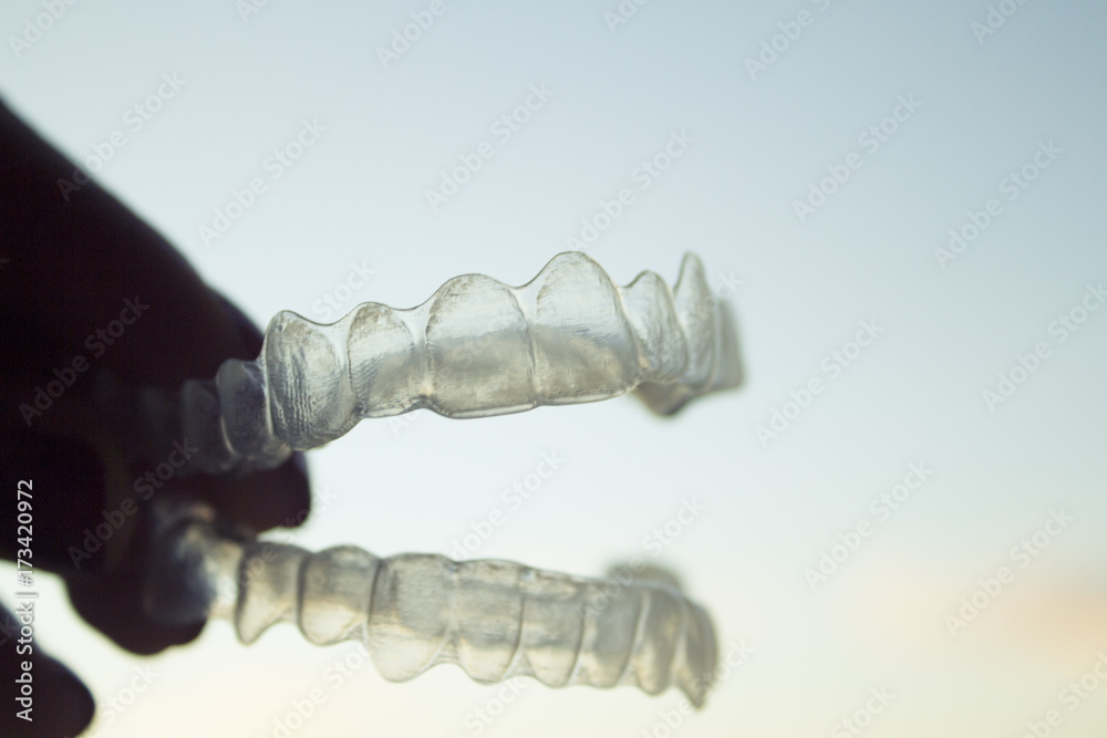 Orthodontics to correct alignment of teeth