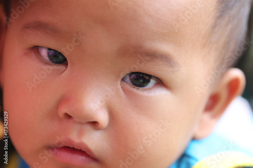 Face of an Asian child boy who is 1 year old.