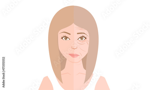 Woman face before and after anti-aging procedures.
