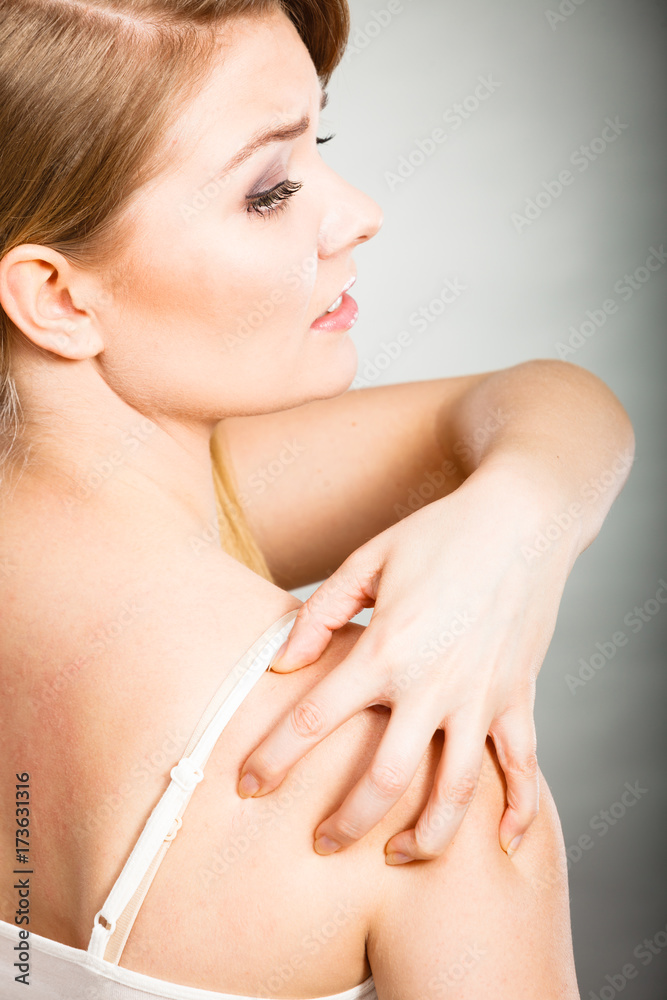 woman scratching her itchy back with allergy rash Stock Photo
