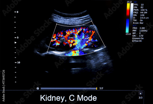 Colourful image of modern ultrasound monitor photo