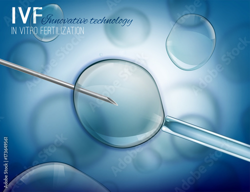 In Vitro Fertilization