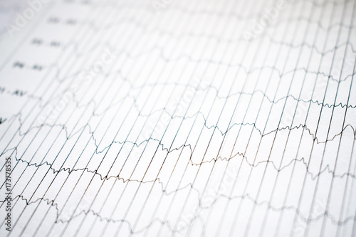 EEG electrophysiological monitoring method. EEG wave in human brain, Brain wave patterns on electroencephalogram, EEG of the child, detect problems in the electrical activity of the brain photo