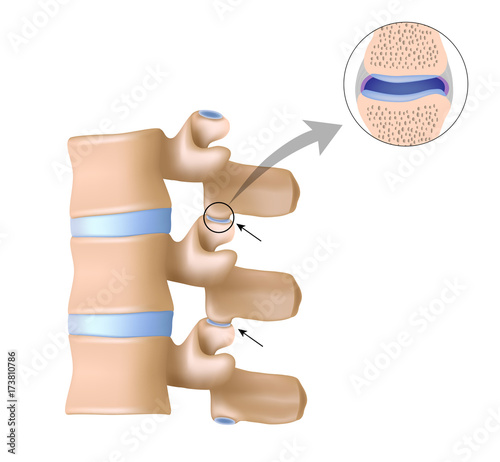 Facet joints unlabeled