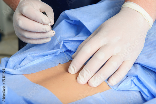 Doctor during spine operation in  operating room photo