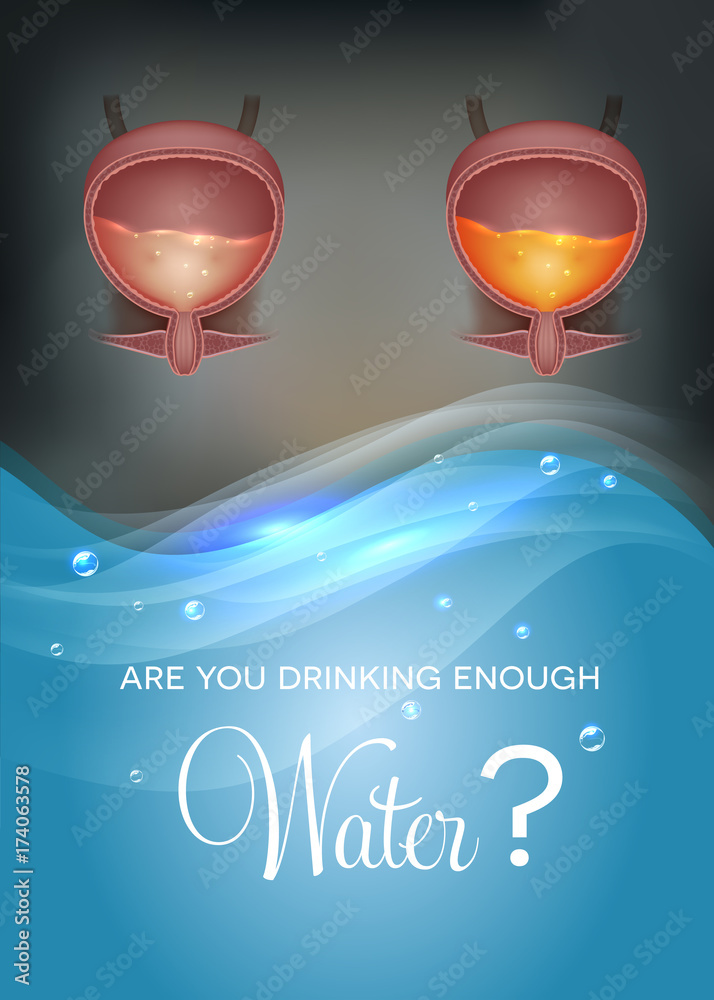 Are You drinking enough water? Drinking water affects urine color