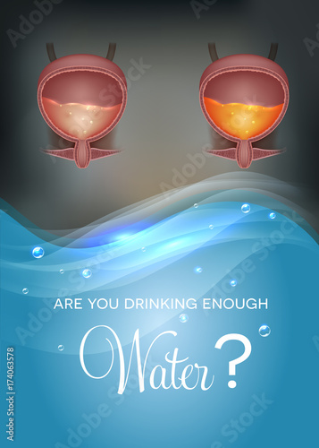 Are You drinking enough water? Drinking water affects urine color. Urinary bladder detailed anatomy and urine inside light and dark yellow color.