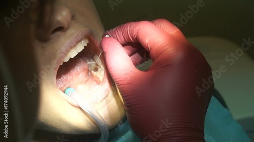 lovely girl treats teeth from dentist photo