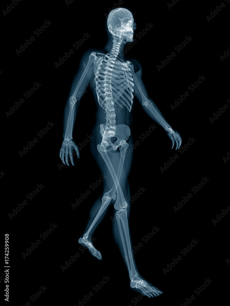 3d rendered medically accurate illustration of a walker x-ray 3d rendered medically accurate illustration of a walker x-ray