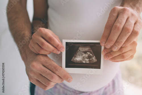 Pregnant couple holding ultrasound scan. Concept of Pregnancy health care.