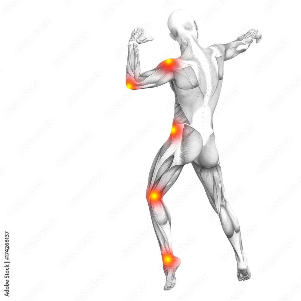 Conceptual human muscle anatomy with red and yellow hot spot inflammation or articular joint pain for health care therapy or sport concepts. 3D illustration man arthritis or bone osteoporosis disease Conceptual human muscle anatomy with red and yellow hot spot inflammation or articular joint pain for health care therapy or sport concepts. 3D illustration man arthritis or bone osteoporosis disease