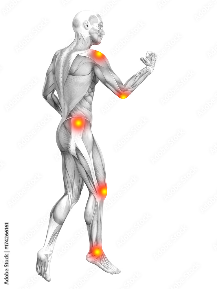 Conceptual human muscle anatomy with red and yellow hot spot inflammation or articular joint pain for health care therapy or sport concepts. 3D illustration man arthritis or bone osteoporosis disease Conceptual human muscle anatomy with red and yellow hot spot inflammation or articular joint pain for health care therapy or sport concepts. 3D illustration man arthritis or bone osteoporosis disease