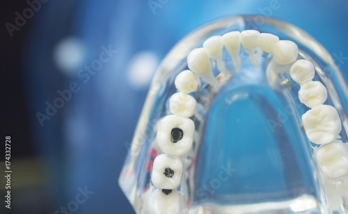Dental teeth mouth model