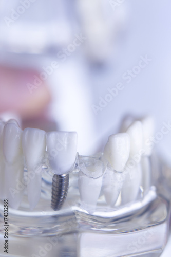 Dentsts dental teeth model