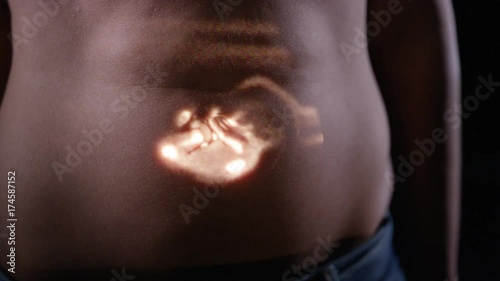  Growing foetus in the womb of expectant mother