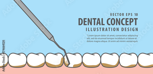 Banner Scaling teeth illustration vector on blue background. Dental concept.