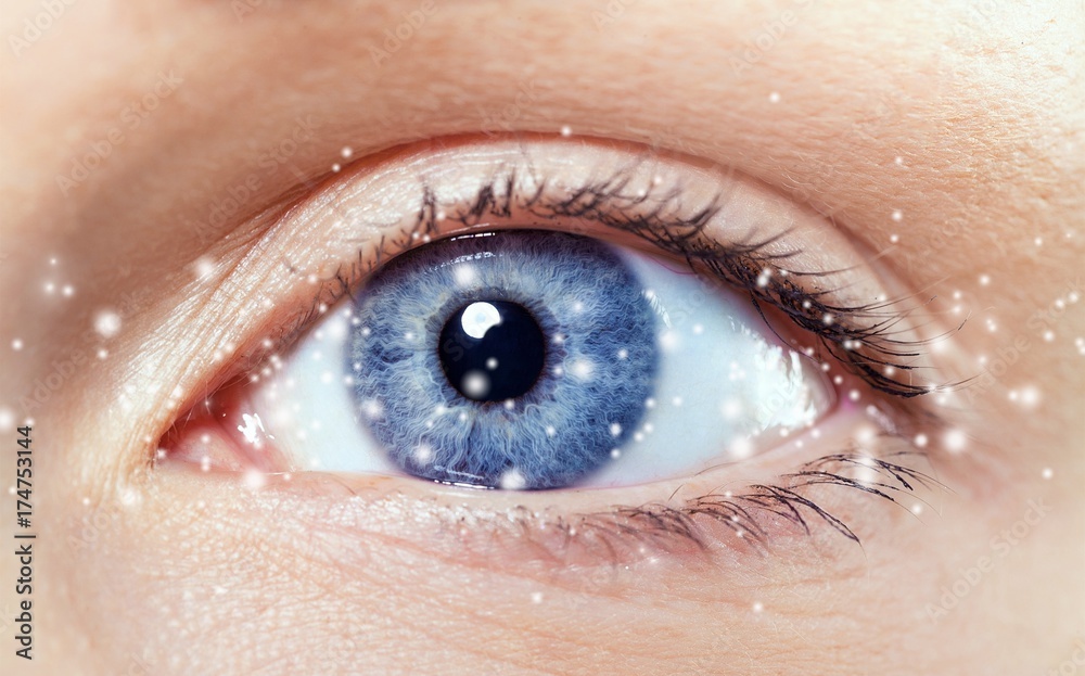 Obraz premium Cataract.