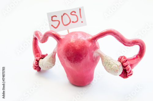 Natural anatomical 3D uterus with ovaries model with placard inscripted SOS referring to patient or doctor for help. Conceived for all symptoms, syndromes, diseases and pathologies of female organs
