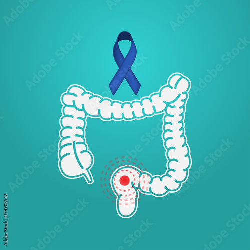 Colon Cancer vector logo icon illustration