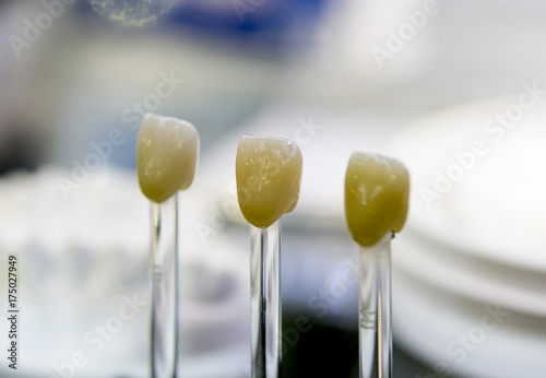 Photography several models artificial human dental crown close-up