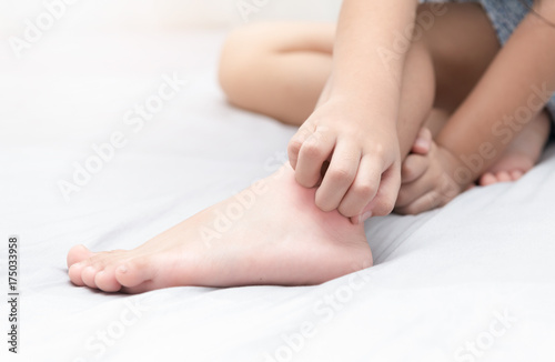 Fototapeta Naklejka Na Ścianę i Meble -  girl scratch the itch with hand on bed