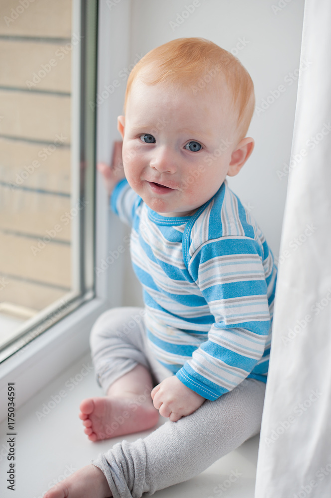 Redheaded baby boy with atopic dermatitis Redheaded baby boy with atopic dermatitis