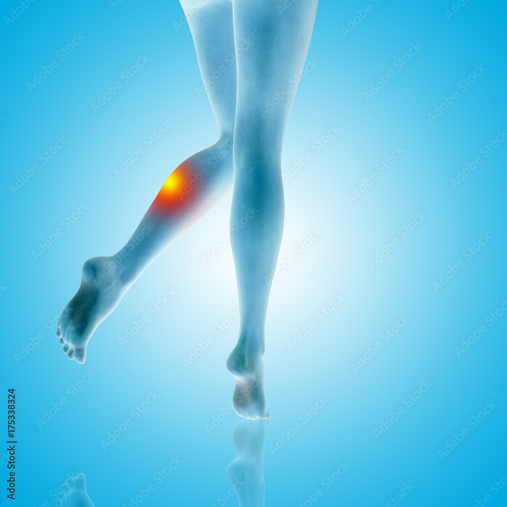 Conceptual beautiful woman or girl legs and feet with a hurt calf pain or ache closeup, 3D illustration of human slim fit body medical or health care concept, painful sport injury on blue background Conceptual beautiful woman or girl legs and feet with a hurt calf pain or ache closeup, 3D illustration of human slim fit body medical or health care concept, painful sport injury on blue background