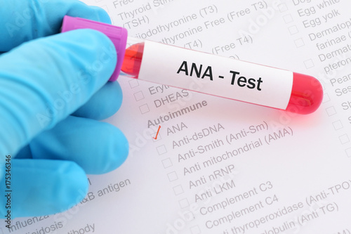 Blood sample with requisition form for ANA (Anti-nuclear antibody) test