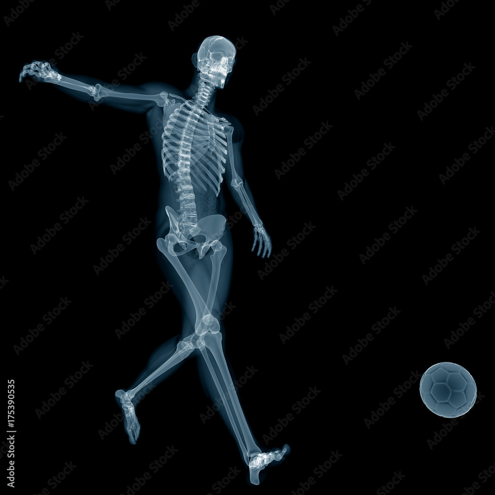 3d rendered medically accurate illustration of football player x-ray