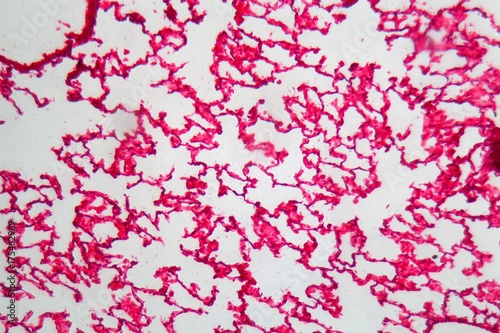 Lung Cells under the Microscope