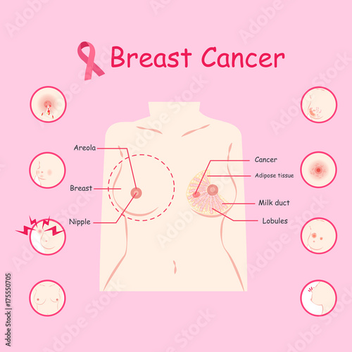woman with breast cancer
