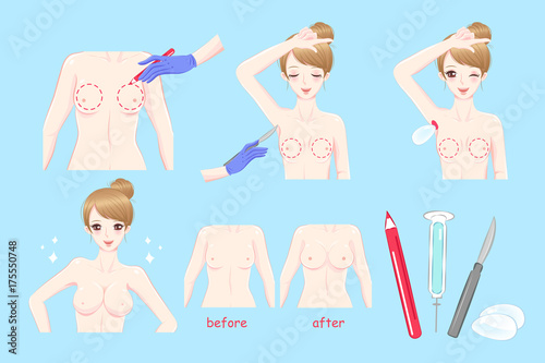 woman with breast augmentation