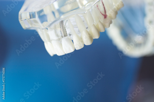 Dental teeth mouth model