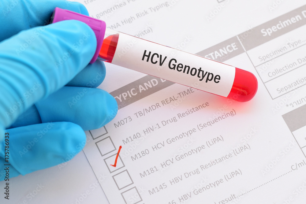 Obraz premium Test tube with blood sample for HCV genotype test